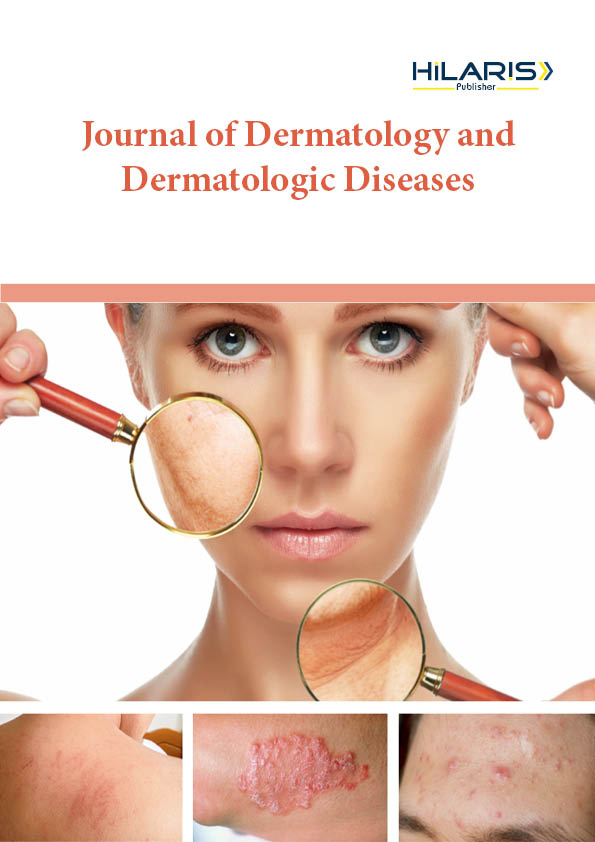 Journal of Dermatology and Dermatologic Diseases