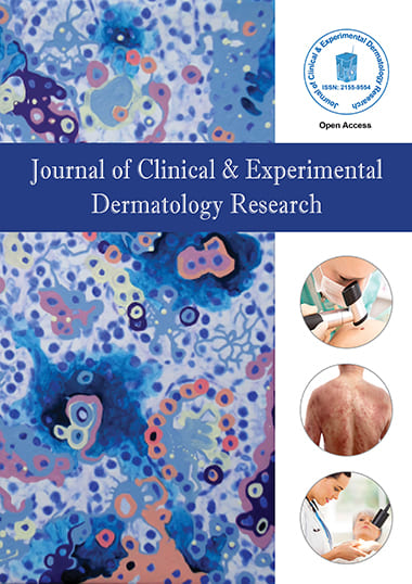 The Journal of Clinical & Experimental Dermatology Research