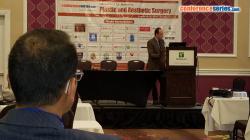 Title #cs/past-gallery/1200/ahmed-walaa-abousheleib-orange-clinics-egypt-international-conference-on-plastic-and-aesthetic-surgery-2016--conferenceseries-5-1472044225