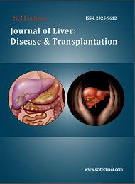Journal of Liver: Disease & Transplantation