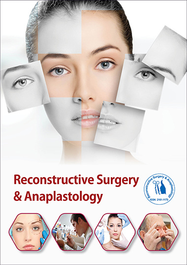 Reconstructive Surgery & Anaplastology
