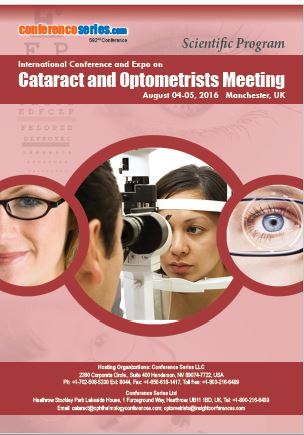 cataract 2016