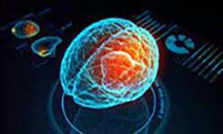 Advancements in Neurology