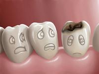 Caries Risk