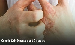Genetic Skin Disorders & Diseases