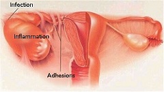 Gynecology and Infectious disease