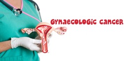 Gynecology Cancer