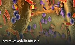 Immunology of Skin Diseases