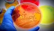 Microbiology-Current Research