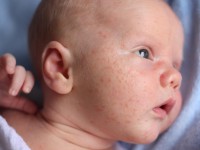 Allergy & Infectious Diseases in Newborns