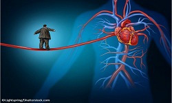 Obesity and Heart disease