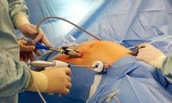 Obstetric and Gynecological Surgery
