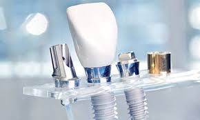 Oral Myology and Oral Implantology