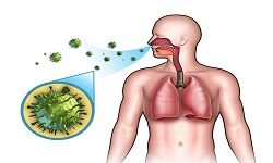 Respiratory tract infections