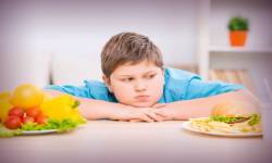 Psychological and Social Factor Causing Obesity