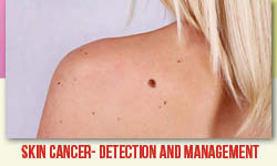  Skin Cancer : Detection & Management