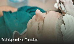 Trichology and Hair Transplant