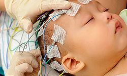 Pediatric Neurology - Neurocognitive 2019