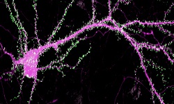 Cellular neurology - Neurocognitive 2019 
