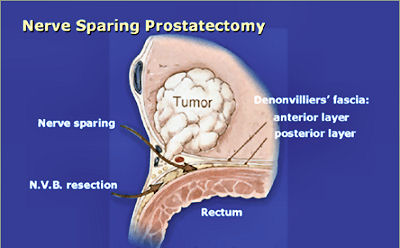 parts pelvis of Cancer  Asia  oncology 2018 Conference    Conferences